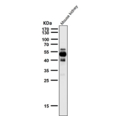 All lanes use the Phospho-Tau (pSer404) antibody at 1:2K dilution for 1 hour at room temperature. The expected molecular weight of phosphorylated Tau (Ser198) is approximately 45-70 kDa, corresponding to the major Tau isoforms, and lower molecular weight bands around ~35 kDa may represent truncated Tau fragments commonly observed in brain tissue.