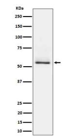 Western blot analysis of Phospho-Tau (S404) expression in mouse brain cell lysate using Phospho-Tau (pSer404) antibody. The expected molecular weight of phosphorylated Tau (Ser198) is approximately 45-70 kDa, corresponding to the major Tau isoforms, and lower molecular weight bands around ~35 kDa may represent truncated Tau fragments commonly observed in brain tissue.