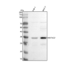 Western blot analysis of C1orf35/MMTAG2 using anti-MMTAG2 antibody. Lane 1: human THP-1 whole cell lysates, Lane 2: human MCF-7 whole cell lysates. After electrophoresis, proteins were transferred to a nitrocellulose membrane at 150 mA for 50-90 minutes. Blocked the membrane with 5% non-fat milk/TBS for 1.5 hour at RT. The membrane was incubated with rabbit anti-MMTAG2 antibody at 0.5 ug/ml overnight at 4oC, then washed with TBS-0.1%Tween 3 times with 5 minutes each and probed with a goat anti-rabbit IgG-HRP secondary antibody at a dilution of 1:5000 for 1.5 hour at RT. The signal was developed using enhanced chemiluminescent. The expected band size for C1orf35/MMTAG2 is approximately 29 kDa, and the protein is commonly observed between 29 and 35 kDa in Western blot analyses, consistent with post-translational modification and migration variability reported for this protein.