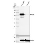 PHGDH Antibody HeLa Knockout Validation WB. Western blot testing of human HeLa wild-type (WT) and PHGDH knockout (KO) cell lysates with PHGDH Antibody at 0.5 ug/ml. Lane 1: HeLa WT; Lane 2: HeLa PHGDH KO. A specific band is detected at approximately 57 kDa in the WT lysate and is absent in the PHGDH KO sample, confirming antibody specificity. GAPDH was used as a loading control. PHGDH Antibody detects endogenous Phosphoglycerate Dehydrogenase expression and supports studies of serine biosynthesis, amino acid metabolism and metabolic pathway regulation.