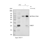 UBE2T Antibody MCF-7 Cell IP. Immunoprecipitation of UBE2T from human MCF-7 whole cell lysate using UBE2T antibody. Lane 1 contains input lysate, lane 2 is the rabbit IgG control, and lane 3 contains the UBE2T immunoprecipitate. Western blot detection at 0.5 ug/ml demonstrates a specific band at approximately 23 kDa, consistent with the expected molecular weight. This UBE2T Antibody, also called Ubiquitin-conjugating Enzyme E2 T Antibody, demonstrates immunoprecipitation of UBE2T from breast cancer cells.