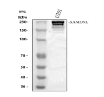 Western blot analysis of SAMD9L using anti-SAMD9L antibody. Lane 1: human U251 whole cell lysates. After electrophoresis, proteins were transferred to a nitrocellulose membrane at 150 mA for 50-90 minutes. Blocked the membrane with 5% non-fat milk/TBS for 1.5 hour at RT. The membrane was incubated with rabbit anti-SAMD9L antibody at 0.5 ug/ml overnight at 4oC, then washed with TBS-0.1%Tween 3 times with 5 minutes each and probed with a goat anti-rabbit IgG-HRP secondary antibody at a dilution of 1:5000 for 1.5 hour at RT. The signal was developed using enhanced chemiluminescent. The expected band size for SAMD9L is at 185 kDa but the protein is often observed as a slightly larger doublet due to various states of phosphorylation.