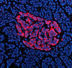 IF analysis of TRIM58 using anti-TRIM58 antibody (red). TRIM58 was detected in a paraffin-embedded section of human pancreas tissue. Heat mediated antigen retrieval was performed in EDTA buffer (pH 8.0, epitope retrieval solution). The tissue section was blocked with 10% goat serum. The tissue section was then incubated with 5 ug/ml rabbit anti-TRIM58 antibody overnight at 4oC. Cy3 Conjugated Goat Anti-Rabbit IgG was used as secondary antibody at 1:500 dilution and incubated for 30 minutes at 37oC. The section was counterstained with DAPI (blue). Visualize using a fluorescence microscope and filter sets appropriate for the label used.