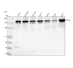 Western blot analysis of CLCN3 using anti-CLCN3 antibody. Lane 1: human Jurkat whole cell lysates, Lane 2: human U-87MG whole cell lysates, Lane 3: human SH-SY6Y whole cell lysates, Lane 4: human MCF-7 whole cell lysates, Lane 5: human whole cell lysates, Lane 6: human Hela whole cell lysates, Lane 7: human K562 whole cell lysates. After electrophoresis, proteins were transferred to a nitrocellulose membrane at 150 mA for 50-90 minutes. Blocked the membrane with 5% non-fat milk/TBS for 1.5 hour at RT. The membrane was incubated with rabbit anti-CLCN3 antibody at 0.5 ug/ml overnight at 4oC, then washed with TBS-0.1%Tween 3 times with 5 minutes each and probed with a goat anti-rabbit IgG-HRP secondary antibody at a dilution of 1:5000 for 1.5 hour at RT. The signal was developed using enhanced chemiluminescent. The expected band size for CLCN3 is at 91 kDa but the protein is N-glycosylated and forms homodimers of ~170 kDa.