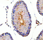 IHC analysis of ODF2 using anti-ODF2 antibody. ODF2 was detected in a paraffin-embedded section of rat testis tissue. Heat mediated antigen retrieval was performed in EDTA buffer (pH 8.0, epitope retrieval solution). The tissue section was blocked with 10% goat serum. The tissue section was then incubated with 2 ug/ml rabbit anti-ODF2 antibody overnight at 4oC. Peroxidase Conjugated Goat Anti-rabbit IgG was used as secondary antibody and incubated for 30 minutes at 37oC. The tissue section was developed using an HRP secondary and DAB substrate.