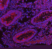 Immunofluorescent staining of FFPE human appendix tissue with HERPUD1 antibody (red) and DAPI nuclear stain (blue). HIER: steam section in pH8 EDTA buffer for 20 min.
