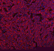 Immunofluorescent staining of FFPE human ovarian tissue with HERPUD1 antibody (red) and DAPI nuclear stain (blue). HIER: steam section in pH8 EDTA buffer for 20 min.