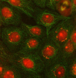 Immunofluorescent staining of OTUD5 using anti-OTUD5 antibody (red) and anti-Beta Tubulin antibody (green). OTUD5 was detected in immunocytochemical section of cell. Enzyme antigen retrieval was performed using IHC enzyme antigen retrieval reagent for 15 mins. The cells were blocked with 10% goat serum. And then incubated with 5 ug/ml rabbit anti-OTUD5 antibody and mouse anti-Beta Tubulin antibody overnight at 4oC. Cy3 Conjugated Goat Anti-Rabbit IgG and FITC Conjugated Goat Anti-Mouse IgG were used as secondary antibody at 1:500 dilution and incubated for 30 minutes at 37oC. Visualize using a fluorescence microscope and filter sets appropriate for the label used.