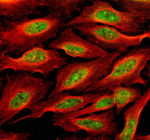 Immunofluorescent staining of NPAT using anti-NPAT antibody (green) and anti-Beta Tubulin antibody (red). NPAT was detected in an immunocytochemical section of U2OS cells. Enzyme antigen retrieval was performed using IHC enzyme antigen retrieval reagent for 15 mins. The cells were blocked with 10% goat serum. And then incubated with 5 ug/ml rabbit anti-NPAT antibody and mouse anti-Beta Tubulin antibody overnight at 4oC. DyLight 488 Conjugated Goat Anti-Rabbit IgG and Cy3 Conjugated Goat Anti-Mouse IgG were used as secondary antibody at 1:500 dilution and incubated for 30 minutes at 37oC. Visualize using a fluorescence microscope and filter sets appropriate for the label used.
