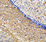 Immunohistochemical staining of PTCD3 using anti-PTCD3 antibody. PTCD3 was detected in a paraffin-embedded section of mouse brain tissue. Heat mediated antigen retrieval was performed in EDTA buffer (pH 8.0, epitope retrieval solution). The tissue section was blocked with 10% goat serum. The tissue section was then incubated with 2 ug/ml rabbit anti-PTCD3 antibody overnight at 4oC. Peroxidase Conjugated Goat Anti-rabbit IgG was used as secondary antibody and incubated for 30 minutes at 37oC. The tissue section was developed using an HRP secondary and DAB substrate.