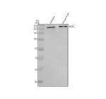 SORL1 Antibody Rat and Mouse Brain WB. Western blot analysis of SORL1 expression was performed using anti-SORL1 antibody. Lane 1: rat brain tissue lysate. Lane 2: mouse brain tissue lysate. SORL1 (Sortilin-Related Receptor 1) is a VPS10-domain sorting receptor that regulates intracellular protein trafficking, endosomal sorting, and receptor recycling, particularly within neurons where it controls amyloid precursor protein (APP) trafficking. A specific immunoreactive band is detected at approximately 250 kDa, consistent with the predicted molecular weight of SORL1 (~248 kDa). These results demonstrate cross-species reactivity and support the utility of SORL1 Antibody for studies of neuronal protein trafficking, endosomal biology, neurodegeneration, and Alzheimer's disease research.