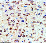 SORL1 Antibody Rat Brain IHC. Immunohistochemical staining of FFPE rat brain tissue with SORL1 antibody demonstrated moderate cytoplasmic and membranous staining in neuronal cells, consistent with the localization of SORL1 (Sortilin-Related Receptor 1), a VPS10-domain sorting receptor that regulates intracellular protein trafficking, endosomal sorting, and receptor recycling. SORL1 is a key regulator of amyloid precursor protein (APP) trafficking and neuronal protein homeostasis, making it an important marker in Alzheimer's disease and neurodegeneration research. Heat-mediated antigen retrieval was performed in pH 8.0 EDTA buffer, followed by overnight incubation with SORL1 antibody at 2 ug/ml. Detection was achieved using an HRP-conjugated secondary antibody and DAB substrate.