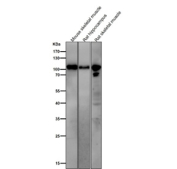 All lanes use the Phospho-AMPA Receptor 1 (pSer831) antibody at 1:1000 dilution for 1 hour at room temperature.