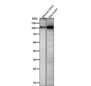 All lanes use the Phospho-AMPA Receptor 1 (pSer831) antibody at 1:1000 dilution for 1 hour at room temperature.
