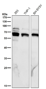 All lanes use the Phospho-p70 S6 Kinase beta (pSer371) antibody at 1:6000 dilution for 1 hour at room temperature.