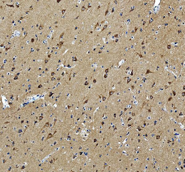 Syntaxin 12 Antibody Human Cerebral Cortex IHC. Immunohistochemical staining of FFPE human cerebral cortex tissue with Syntaxin 12 antibody at 2 ug/ml. Heat-induced epitope retrieval (HIER) was performed by boiling tissue sections in pH 8 EDTA buffer prior to staining. Syntaxin 12 immunoreactivity is observed predominantly within the cytoplasm of cortical neurons and throughout the surrounding neuropil, consistent with the expected localization of this endosomal SNARE protein involved in intracellular vesicle trafficking and endosomal membrane fusion. Cell nuclei are counterstained with hematoxylin (blue).