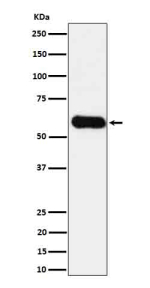 ICOSLG Antibody HUVEC WB. Western blot analysis of CD275 in HUVEC cell lysate using ICOSLG antibody.