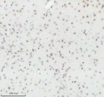 Histone H3 (Tri-Methyl K27) Antibody Rat Brain IHC. Immunohistochemical staining of FFPE rat brain tissue using Histone H3 (Tri-Methyl K27) Antibody / Epigenetic Histone Marker Antibody at a 1:50 dilution. An HRP-conjugated goat anti-rabbit IgG secondary antibody with DAB substrate was used for detection. Histone H3 (Tri-Methyl K27) Antibody demonstrates strong nuclear staining throughout the brain tissue, consistent with the nuclear localization of H3K27 trimethylation as an epigenetic marker associated with transcriptional repression.