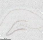 Histone H3 (Tri-Methyl K27) Antibody Rat Hippocampus IHC. Immunohistochemical staining of FFPE rat brain (hippocampus) tissue using Histone H3 (Tri-Methyl K27) Antibody / Epigenetic Histone Marker Antibody at a 1:50 dilution. An HRP-conjugated goat anti-rabbit IgG secondary antibody with DAB substrate was used for detection. Histone H3 (Tri-Methyl K27) Antibody demonstrates widespread nuclear staining throughout the hippocampal formation, consistent with the nuclear localization of H3K27 trimethylation as an epigenetic marker associated with transcriptional repression.