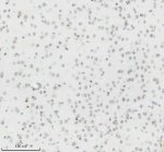 Histone H3 (Tri-Methyl K27) Antibody Mouse Brain IHC. Immunohistochemical staining of FFPE mouse brain tissue using Histone H3 (Tri-Methyl K27) Antibody / Epigenetic Histone Marker Antibody at a 1:50 dilution. An HRP-conjugated goat anti-rabbit IgG secondary antibody with DAB substrate was used for detection. Histone H3 (Tri-Methyl K27) Antibody demonstrates widespread nuclear staining throughout the brain tissue, consistent with the nuclear localization of H3K27 trimethylation as an epigenetic marker associated with transcriptional repression.