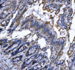 Immunohistochemical staining of SEC61G using anti-SEC61G antibody. SEC61G was detected in a paraffin-embedded section of rat colon tissue. Heat mediated antigen retrieval was performed in EDTA buffer (pH 8.0, epitope retrieval solution). The tissue section was blocked with 10% goat serum. The tissue section was then incubated with 2 ug/ml rabbit anti-SEC61G antibody overnight at 4oC. Peroxidase Conjugated Goat Anti-rabbit IgG was used as secondary antibody and incubated for 30 minutes at 37oC. The tissue section was developed using an HRP secondary and DAB substrate.