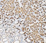 ATP4B Antibody Human Stomach IHC. Immunohistochemical staining of FFPE human stomach tissue using ATP4B antibody at 2 ug/ml. An HRP-conjugated goat anti-rabbit IgG secondary antibody with DAB substrate was used for detection. ATP4B antibody demonstrates strong cytoplasmic and membranous staining of gastric parietal cells, while adjacent gastric glandular cells show little to no immunoreactivity.