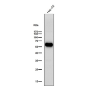 ALDH2 Antibody HepG2 WB. Western blot analysis of ALDH2 expression was performed using anti-ALDH2 antibody in human HepG2 cell lysate. ALDH2, also known as Aldehyde Dehydrogenase 2, is a mitochondrial enzyme that catalyzes the detoxification of reactive aldehydes generated during alcohol metabolism, lipid peroxidation, and oxidative stress. A strong immunoreactive band is detected at approximately 56 kDa, corresponding to the predicted molecular weight of ALDH2. Robust expression in HepG2 hepatocellular carcinoma cells is consistent with the important role of ALDH2 in hepatic aldehyde metabolism and mitochondrial detoxification pathways. The blot was probed with ALDH2 antibody at a 1:3000 dilution for 1 hour at room temperature. These results support the utility of ALDH2 Antibody for studies of aldehyde metabolism, mitochondrial function, oxidative stress responses, and liver biology.