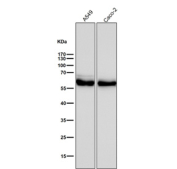 ALDH2 Antibody A549 and Caco-2 WB. Western blot analysis of ALDH2 expression was performed using anti-ALDH2 antibody in human A549 and Caco-2 cell lysates. ALDH2, also known as Aldehyde Dehydrogenase 2, is a mitochondrial enzyme that catalyzes the oxidation and detoxification of reactive aldehydes generated during alcohol metabolism, lipid peroxidation, and oxidative stress. Lane 1: A549 lysate. Lane 2: Caco-2 lysate. A prominent immunoreactive band is detected at approximately 56 kDa in both cell lines, corresponding to the expected molecular weight of ALDH2. Expression in lung carcinoma-derived A549 cells and intestinal epithelial-derived Caco-2 cells is consistent with the widespread requirement for mitochondrial aldehyde detoxification and cellular protection against oxidative damage. All lanes were probed with ALDH2 antibody at a 1:3000 dilution for 1 hour at room temperature. These results support the utility of ALDH2 Antibody for studies of aldehyde metabolism, mitochondrial function, oxidative stress responses, and cellular detoxification pathways.