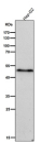 All lanes use the Phospho-VASP (pSer156) antibody at 1:5000 dilution for 1 hour at room temperature.