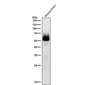 Western blot testing of mouse brain tissue lysate with Phospho-Chk2 (pSer33/pSer35) antibody at 1:1000 dilution for 1 hour at room temperature. Predicted molecular weight ~61 kDa.