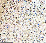Immunohistochemical staining of RNF220 using anti-RNF220 antibody. RNF220 was detected in a paraffin-embedded section of mouse brain tissue. Heat mediated antigen retrieval was performed in EDTA buffer (pH 8.0, epitope retrieval solution). The tissue section was blocked with 10% goat serum. The tissue section was then incubated with 2 ug/ml rabbit anti-RNF220 antibody overnight at 4oC. Peroxidase Conjugated Goat Anti-rabbit IgG was used as secondary antibody and incubated for 30 minutes at 37oC. The tissue section was developed using an HRP secondary and DAB substrate.