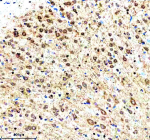 Immunohistochemical staining of RNF220 using anti-RNF220 antibody. RNF220 was detected in a paraffin-embedded section of rat brain tissue. Heat mediated antigen retrieval was performed in EDTA buffer (pH 8.0, epitope retrieval solution). The tissue section was blocked with 10% goat serum. The tissue section was then incubated with 2 ug/ml rabbit anti-RNF220 antibody overnight at 4oC. Peroxidase Conjugated Goat Anti-rabbit IgG was used as secondary antibody and incubated for 30 minutes at 37oC. The tissue section was developed using an HRP secondary and DAB substrate.