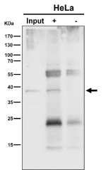 Immunoprecipitation analysis using the NSDHL antibody at 1:50 dilution. Western blot at 1:1000 dilution. NSDHL is an ER-associated membrane protein that typically migrates faster on SDS-PAGE due to signal peptide cleavage and altered SDS binding and is commonly observed at ~38 kDa.