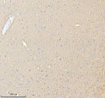 Immunohistochemical staining of PACSIN1 using anti-PACSIN1 antibody. PACSIN1 was detected in a paraffin-embedded section of mouse brain tissue. Heat mediated antigen retrieval was performed in EDTA buffer (pH 8.0, epitope retrieval solution). The tissue section was blocked with 10% goat serum. The tissue section was then incubated with 2 ug/ml rabbit anti-PACSIN1 antibody overnight at 4oC. Peroxidase Conjugated Goat Anti-rabbit IgG was used as secondary antibody and incubated for 30 minutes at 37oC. The tissue section was developed using an HRP secondary and DAB substrate.