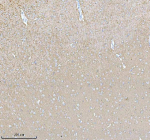 Immunohistochemical staining of PACSIN1 using anti-PACSIN1 antibody. PACSIN1 was detected in a paraffin-embedded section of rat brain tissue. Heat mediated antigen retrieval was performed in EDTA buffer (pH 8.0, epitope retrieval solution). The tissue section was blocked with 10% goat serum. The tissue section was then incubated with 2 ug/ml rabbit anti-PACSIN1 antibody overnight at 4oC. Peroxidase Conjugated Goat Anti-rabbit IgG was used as secondary antibody and incubated for 30 minutes at 37oC. The tissue section was developed using an HRP secondary and DAB substrate.