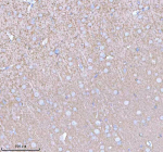 Immunohistochemical staining of PACSIN1 using anti-PACSIN1 antibody. PACSIN1 was detected in a paraffin-embedded section of rat brain tissue. Heat mediated antigen retrieval was performed in EDTA buffer (pH 8.0, epitope retrieval solution). The tissue section was blocked with 10% goat serum. The tissue section was then incubated with 2 ug/ml rabbit anti-PACSIN1 antibody overnight at 4oC. Peroxidase Conjugated Goat Anti-rabbit IgG was used as secondary antibody and incubated for 30 minutes at 37oC. The tissue section was developed using an HRP secondary and DAB substrate.