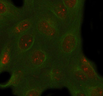 Immunofluorescent staining of PACSIN1 using anti-PACSIN1 antibody (red) and anti-Beta Tubulin antibody (green). PACSIN1 was detected in immunocytochemical section of U2OS cell. Enzyme antigen retrieval was performed using IHC enzyme antigen retrieval reagent for 15 mins. The cells were blocked with 10% goat serum. And then incubated with 5 ug/ml rabbit anti-PACSIN1 antibody and mouse anti-Beta Tubulin antibody overnight at 4oC. Cy3 Conjugated Goat Anti-Rabbit IgG and FITC Conjugated Goat Anti-Mouse IgG were used as secondary antibody at 1:500 dilution and incubated for 30 minutes at 37oC. Visualize using a fluorescence microscope and filter sets appropriate for the label used.