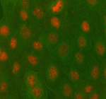 Immunofluorescent staining of PBX4 using anti-PBX4 antibody (red) and anti-Beta Tubulin antibody (green). PBX4 was detected in immunocytochemical section of cell. Enzyme antigen retrieval was performed using IHC enzyme antigen retrieval reagent for 15 mins. The cells were blocked with 10% goat serum. And then incubated with 5 ug/ml rabbit anti-PBX4 antibody and mouse anti-Beta Tubulin antibody overnight at 4oC. Cy3 Conjugated Goat Anti-Rabbit IgG and FITC Conjugated Goat Anti-Mouse IgG were used as secondary antibody at 1:500 dilution and incubated for 30 minutes at 37oC. Visualize using a fluorescence microscope and filter sets appropriate for the label used.