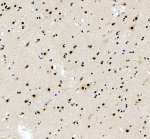 PRDM6 Antibody by IHC in human cerebral cortex. Immunohistochemistry of FFPE human cerebral cortex using PRDM6 Antibody at 2 ug/ml. Brown DAB immunoreactivity is visible in scattered cells throughout the tissue, with staining associated with neuronal cell bodies and surrounding structures. Hematoxylin counterstaining highlights blue nuclei. Heat-mediated antigen retrieval was performed using EDTA buffer (pH 8.0), followed by overnight primary antibody incubation at 4oC. This antibody detects PR domain zinc finger protein 6, a transcriptional regulator involved in chromatin modification and gene expression.