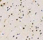 PRDM6 Antibody by IHC in human cerebral cortex at higher magnification. Immunohistochemistry of FFPE human cerebral cortex using PRDM6 Antibody at 2 ug/ml. This field shows scattered brown immunoreactivity in cells with neuronal morphology, including prominent staining in several cell bodies. Smaller surrounding cells exhibit variable staining, while hematoxylin counterstaining identifies blue nuclei. Antigen retrieval was performed using EDTA buffer (pH 8.0), followed by overnight incubation at 4oC. The staining demonstrates immunoreactivity for PR domain zinc finger protein 6 within human cerebral cortex tissue.