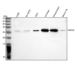 Western blot analysis of RSPO4 using anti-RSPO4 antibody. Lane 1: human U20S whole cell lysates, Lane 2: human SH-SY5Y whole cell lysates, Lane 3: human 293T whole cell lysates, Lane 4: rat brain tissue lysates, Lane 5: mouse brain tissue lysates, Lane 6: mouse Neuro-2a whole cell lysates. After electrophoresis, proteins were transferred to a nitrocellulose membrane at 150 mA for 50-90 minutes. Blocked the membrane with 5% non-fat milk/TBS for 1.5 hour at RT. The membrane was incubated with rabbit anti-RSPO4 antibody at 0.5 ug/ml overnight at 4oC, then washed with TBS-0.1%Tween 3 times with 5 minutes each and probed with a goat anti-rabbit IgG-HRP secondary antibody at a dilution of 1:5000 for 1.5 hour at RT. The signal was developed using enhanced chemiluminescent. The expected molecular weight of RSPO4 is ~26 kDa.