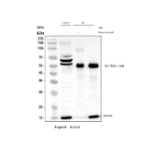 Immunoprecipitation of RPS19 protein from 500ug of human K562 whole cell lysate with 2ug of RPS19 antibody.