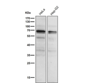 All lanes use the Phospho-PKC alpha (pThr497) antibody at 1:1000 dilution for 1 hour at room temperature.