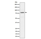 Western blot analysis of Phospho-PKC alpha (pT497) expression in HeLa treated with Calyculin A cell lysate, using Phospho-PKC alpha (Thr497) antibody.
