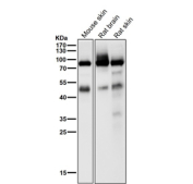 All lanes use the Phospho-PKC alpha (pThr497) antibody at 1:1000 dilution for 1 hour at room temperature.