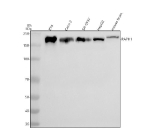 Western blot analysis of RAPH1 using anti-RAPH1 antibody. Electrophoresis was performed on a 8% SDS-PAGE gel at 80V (Stacking gel) / 120V (Resolving gel) for 2 hours. Lane 1: human RT4 whole cell lysates, Lane 2: human Caco-2 whole cell lysates, Lane 3: human SH-SY5Y whole cell lysates, Lane 4: human HepG2 whole cell lysates, Lane 5: mouse brain tissue lysates. After electrophoresis, proteins were transferred to a nitrocellulose membrane at 150 mA for 50-90 minutes. Blocked the membrane with 5% non-fat milk/TBS for 1.5 hour at RT. The membrane was incubated with rabbit anti-RAPH1 antibody at 0.5 ug/ml overnight at 4oC, then washed with TBS-0.1%Tween 3 times with 5 minutes each and probed with a goat anti-rabbit IgG-HRP secondary antibody at a dilution of 1:5000 for 1.5 hour at RT. The signal was developed using an ECL Plus Western Blotting Substrate. RAPH1 (Lamellipodin, ~135 kDa predicted) was detected as a single band at ~150-180 kDa, consistent with its extended proline-rich sequence and post-translational modifications that retard migration on SDS-PAGE.