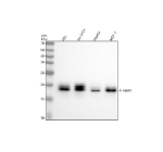 Phospho-4EBP1 Antibody Multi-Cell WB. Western blot analysis of human HEL, SH-SY5Y, HepG2, and MCF-7 cell lysates using phospho-4EBP1 antibody detecting 4EBP family proteins phosphorylated at Thr46, clone 32E52. A band is detected at approximately 18 kDa across all samples, consistent with the predicted molecular weight of 4EBP proteins. Detection across multiple cell lines reflects basal phosphorylation and early-stage regulation of translation control pathways.