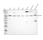 Western blot analysis of POMGNT2 using anti-POMGNT2 antibody. Lane 1: human 293T whole cell lysates, Lane 2: human PC-3 whole cell lysates, Lane 3: human Jurkat whole cell lysates, Lane 4: human U2OS whole cell lysates, Lane 5: rat brain tissue lysates, Lane 6: mouse brain tissue lysates, Lane 7: mouse pancreas tissue lysates. After electrophoresis, proteins were transferred to a nitrocellulose membrane at 150 mA for 50-90 minutes. Blocked the membrane with 5% non-fat milk/TBS for 1.5 hour at RT. The membrane was incubated with rabbit anti-POMGNT2 antibody at 0.5 ug/ml overnight at 4oC, then washed with TBS-0.1%Tween 3 times with 5 minutes each and probed with a goat anti-rabbit IgG-HRP secondary antibody at a dilution of 1:5000 for 1.5 hour at RT. The signal was developed using enhanced chemiluminescent. POMGNT2 (~67 kDa predicted) was detected primarily at ~75â90 kDa, consistent with N-linked glycosylation that slows migration on SDS-PAGE. Additional higher and lower bands in rodent tissues likely represent differentially glycosylated or partially processed enzyme forms.