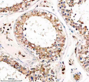Immunohistochemical staining of TRIM59 using anti-TRIM59 antibody. TRIM59 was detected in a paraffin-embedded section of human testis tissue. Heat mediated antigen retrieval was performed in EDTA buffer (pH 8.0, epitope retrieval solution). The tissue section was blocked with 10% goat serum. The tissue section was then incubated with 2 ug/ml rabbit anti-TRIM59 antibody overnight at 4oC. Peroxidase Conjugated Goat Anti-rabbit IgG was used as secondary antibody and incubated for 30 minutes at 37oC. The tissue section was developed using an HRP secondary and DAB substrate.