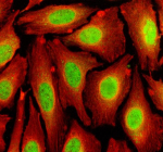 Immunofluorescent staining of TFDP3 using anti-TFDP3 antibody (green) and anti-Beta Tubulin antibody (red). TFDP3 was detected in an immunocytochemical section of U2OS cells. Enzyme antigen retrieval was performed using IHC enzyme antigen retrieval reagent for 15 mins. The cells were blocked with 10% goat serum. And then incubated with 5 ug/ml rabbit anti-TFDP3 antibody and mouse anti-Beta Tubulin antibody overnight at 4oC. DyLight 488 Conjugated Goat Anti-Rabbit IgG and Cy3 Conjugated Goat Anti-Mouse IgG were used as secondary antibody at 1:500 dilution and incubated for 30 minutes at 37oC. Visualize using a fluorescence microscope and filter sets appropriate for the label used.